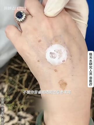 焦恩俊同款人民好物官方推荐碧泉之花极光水+3 77精华组合