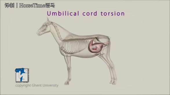Foal in Mare | 脐带扭转 正常马驹的脐带长度通常为 36–83 cm,平均约 55 cm;而病变脐带常明显偏长,可达 62–125 cm,平均约 96 cm。正常脐带可见一定程度的扭转,因此单纯扭转并不代表异常;只有当脐带局部出现肿胀、变色时,才应考虑因血管受阻导致胎儿死亡,此类胎儿常伴有轻至中度自溶。脐带过长可能缠绕胎儿四肢、躯干或绕于胸部、颈部、头部,造成压迫,影响供血供氧。相反,脐带过短则可能在分娩过程中因提前断裂而导致胎儿缺氧甚至死胎。因此,脐带长度和形态是评估流产或死胎原因时的重要检查内容。
#FoalinMare #马 #小马驹 #兽医 #繁育