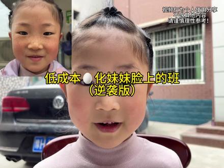 给妹妹🥚班详细版,个人纯分享,请谨慎理智参考
#雀斑#晒斑#黄褐斑#淡斑#美白