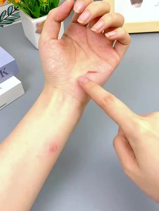 家有小孩的,这种自带碘伏的棉签一定要备上,它是独立包装的,干净卫生,蚊虫叮咬,磕磕碰碰都应该涂上。#碘伏棉签#碘伏棉棒#宝妈推荐#实用好物##生活好帮手
