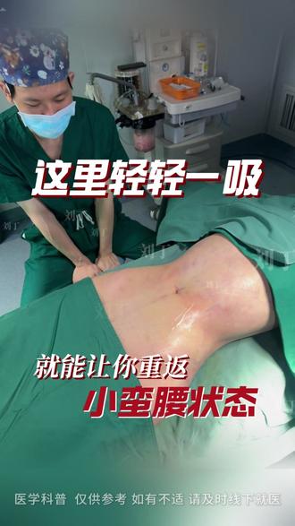 3D纤体精雕疑惑解答 #腰腹环吸 #小蛮腰 #瘦肚子 #体雕 #3D纤体精雕