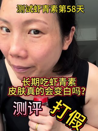 长期吃虾青素皮肤真的会变白吗?测试第58天#变美 #逆袭 #无美颜无滤镜 #测评 #虾青素