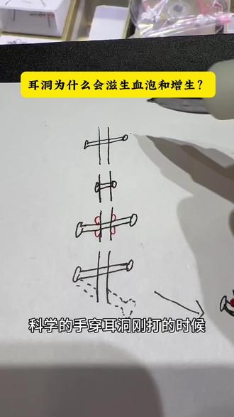 及时更换短杆的重要性#耳洞护理小技巧 #穿孔避坑指南 #手穿耳洞注意事项 #耳洞养护小知识 #穿孔经验分享 @南阳手工穿刺耳洞萍萍