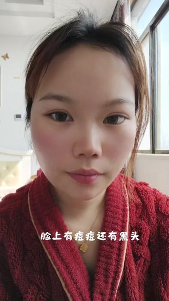 适合新手宝宝的温和水杨酸棉片#若美欣 #水杨酸棉片 #杏仁酸棉片 #湿敷 #黑头闭口