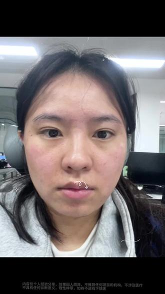 原生脸顶号怎么怎么办?👌看我妙手回春 #变美 #逆袭 #vlog日常