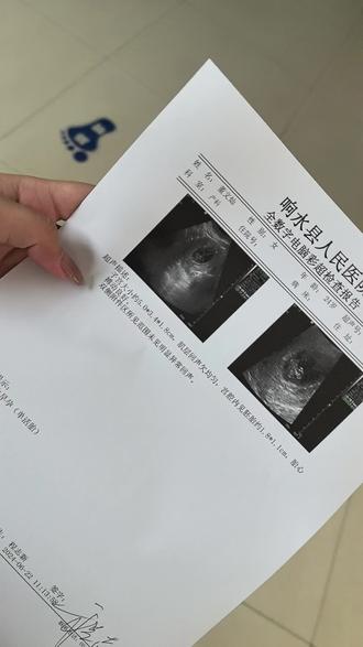 分别这个词,我好像永远都学不会 十个月怀胎,一朝相见
日夜相守400多天,从未分开
今天为了生活,不得不暂时别离
纵有万般不舍,也只能藏在心里
我的男孩,妈妈永远是你最坚实的依靠#职场妈妈 #第一次和宝宝分开 #万般不舍 #我的男孩 #妈妈的爱