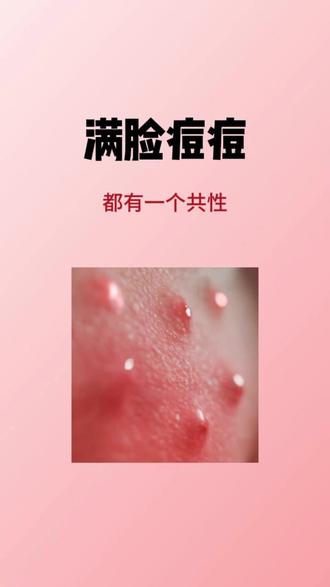 油痘肌闭眼入啦,溪木源 愈创木帮您调节水油平衡啦#溪木源油痘肌新肌愈 #愈创木