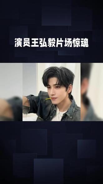 演员王弘毅受伤#王弘毅