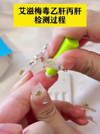 艾滋梅毒乙肝丙肝试纸检测过程,谈恋爱奔现的真的要测一下感染四项才可以放心 #恋爱 #奔现 #情侣 #感染四项 #自测健康