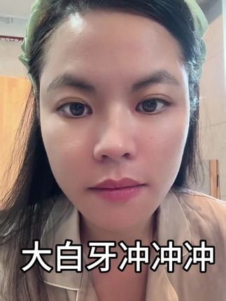 把我刷美了,不信你试试, #牙齿美白#营地女王#玉龙雪山#白沙古镇#小岛家咖啡