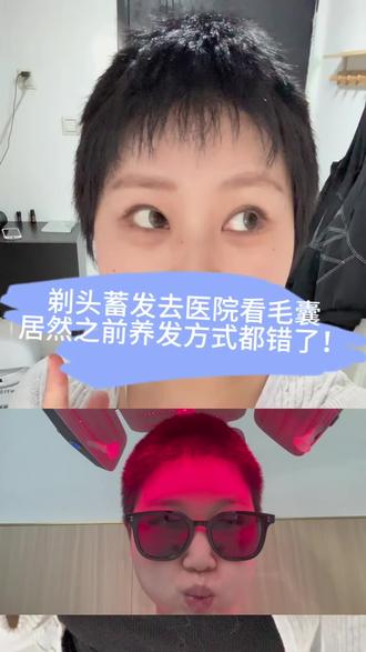剃头蓄发看了医生才知道,原来之前方法都错了啊,家人们一起避雷吧!#无美颜无滤镜拍摄 #剃头蓄发 #剃头 #养发 #养发小妙招 @