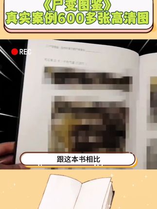 25个真实案例,600多张高清照片,自然环境下,早期尸体到晚期尸体直至全部白骨化的现象#尸检 #尸变图鉴 #科普 #法医 #探案