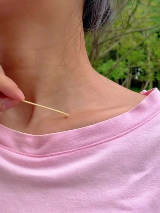 #脖子上的小肉粒怎么去除 #女人爱美不分年龄