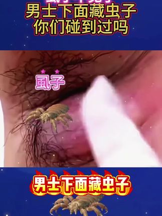 仁和药业百部酊喷雾剂男女阴用成人祛除虱子虱卵虱立净一扫光正品#长虱子怎么消除 #消除虱子卵的小妙招 #身上长虱子怎么消除 #草本植物 #百部酊喷剂语音转文字