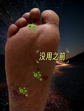 后悔没早点知道,原来这么好用。#女生的脚 #足部护理 #脚痒 #美脚 #dou上热门