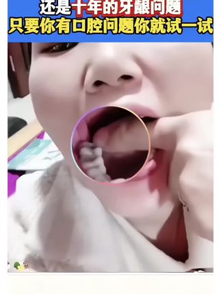 牙齿问问题看过来!没有对比就没有伤害!你就相信一次#爱牙护牙 #保护牙齿 #牙膏#口腔健康