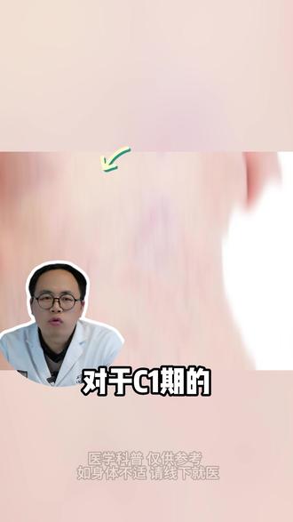 静脉曲张硬化剂注射的优缺点 #硬化剂注射 #血管外科#静脉曲张#健康科普#外科医生