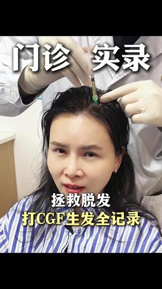 告别脱发焦虑!医生自用生发项目,发量逆袭解决方案 #生发防脱#防脱生发#养发#CGF#头皮护理