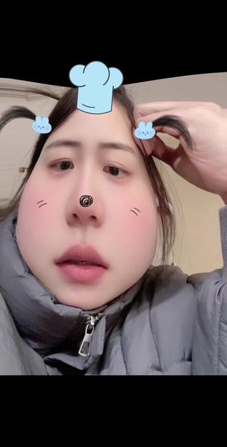 荨麻疹而已,这不可以成为我减肥路上的绊脚石,总会有办法的#减肥 #减肥后遗症 #高碳减肥