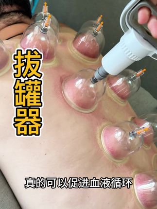 平时多拔罐真的挺有用!#拔罐 #养生 #健康 #按摩