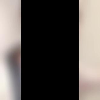 和大家分享一下甲状腺术后如何拔引流管的❤️