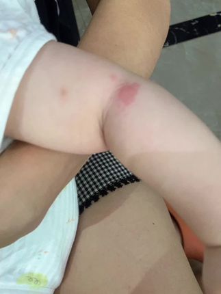 “最怕蚊子咬宝宝,又痒又闹心都碎了!😭物理防蚊才安心!咱家折叠蚊帐,罩住小床/推车,蚊子干着急!一秒开合,一拎就走,遛娃旅行说走就走~收起来巴掌大,不占地儿!宝宝安睡整晚,妈妈终于能松口气!💪#蚊帐 #婴儿蚊帐 #防蚊必备 #带娃好物