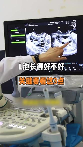 卵泡好不好,主要看这3点 #备孕 #备孕困难 #北京家圆 #试管 #试管移植