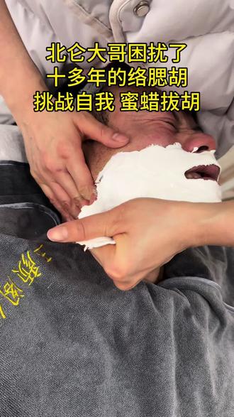 北仑的兄弟别再忍胡子拉碴了!蜜蜡拔胡子一次清干净,根根拔起超清爽,不留黑茬不扎手,做完脸蛋滑溜溜~小雪姐家专业操作,快来体验干净利落的清爽感!#脱胡子#男士修面 #同城男士修面#北仑#北仑玉颜阁老刀修面