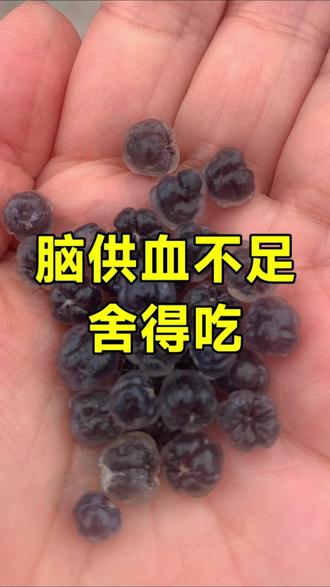 脑供血不足,认准3水果,大脑清醒有活力 #脑供血不足 #健康科普 #菲畅益