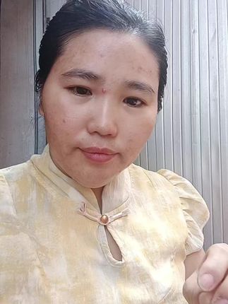 #上热搜 #淡斑护肤 #痘痘肌 #美白淡斑 #自用好物推荐