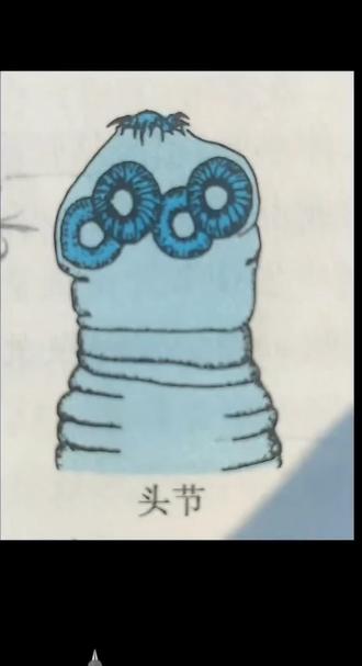 猪带绦虫(链状带绦虫)头节