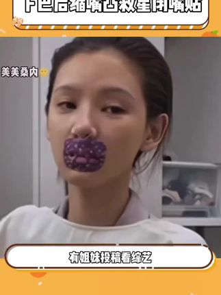 跟着#张予曦 一起贴#口呼吸矫正贴 提升颜值,每晚贴一下,嘴不凸了,牙不凸了,下巴也不后缩了,想要变美的宝子闭眼冲!#闭嘴贴 #口呼吸会变丑 #下巴后缩