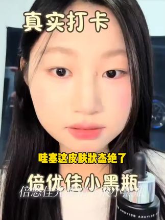 倍悠佳光感精华液小黑瓶提亮肤色保湿面部精华改善暗沉熬夜去黄#小提琴🎻独奏 #永远的爱人男声版 #盧巧音 #星夜钢琴手