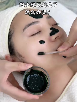 做小绿膜起皮了怎么办?#小绿膜 #皮肤管理