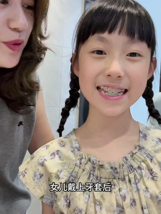 女儿戴上牙套后牙齿一点状况也没有 全靠我早早给她用了这款钢牙专用牙膏#牙膏 #牙膏推荐 #牙套 #爱牙护牙