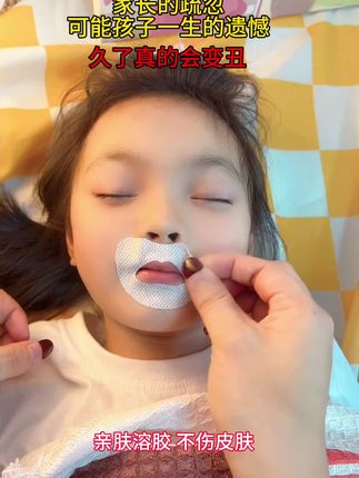 家有总张嘴睡觉的孩子,一定要及时纠正,等牙凸了后悔也来不及了!#闭嘴贴#张嘴呼吸会变丑#小孩张嘴睡觉的纠正方法