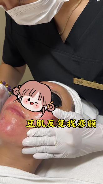 科学战痘 让你远离痘肌反复#蚌埠#痘痘反复