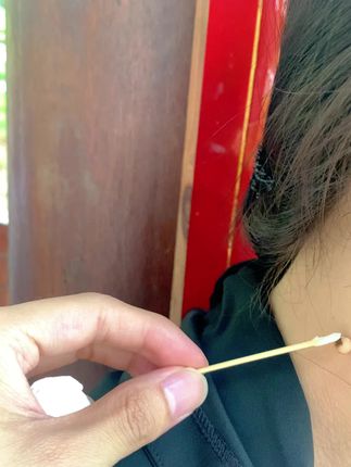 #变美就是这么简单 #女人爱美不分年龄 #脖子上的小肉粒怎么祛除