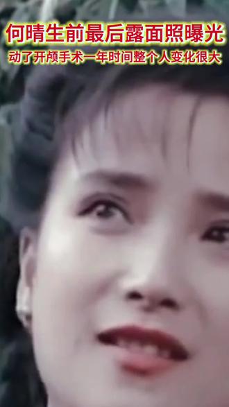 何晴生前最后露面照曝光!动了开颅手术,一年时间整个人变化很大!#何晴