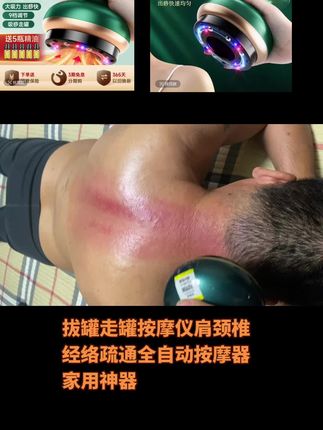 电动拔罐器,在家自己就能拔,充电款很方便,可刮痧拔罐,用完很轻松!!#刮痧拔罐 #拔罐养生
