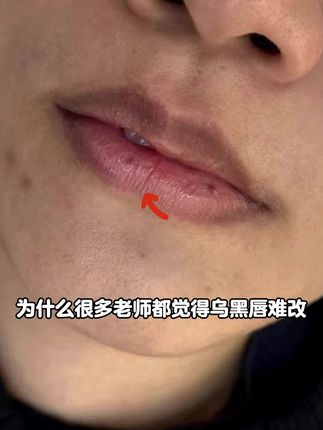 乌黑难改!?那是色乳没选对!!!,#纹绣 #色乳 #纹绣师 #改乌唇 #改乌唇配色