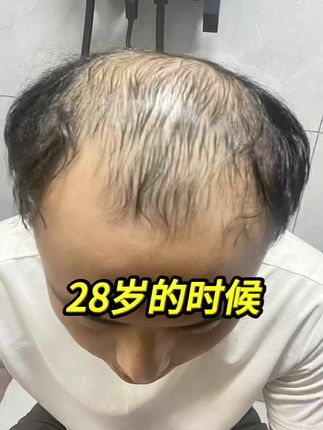 新疆乌斯曼草,洗发皂,真的好用 #新疆乌斯曼草 #洗发水 #洗发皂
