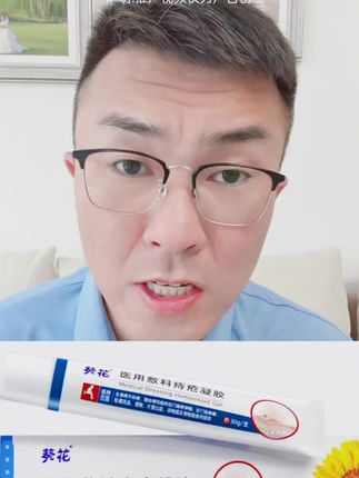 优禾康葵花辅料痔疮凝胶#痔疮凝胶