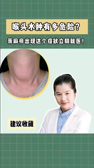 喉头水肿有多危险? 荨麻疹出现这个症状立刻就医! #健康科普破圈计划#抖出健康知识宝藏#皮肤问题#皮肤科#荨麻疹怎么办