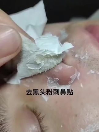 泰国white芦荟胶去黑头鼻贴祛黑头粉刺闭口导出液收缩毛孔男女。#好物推荐 # 去黑头