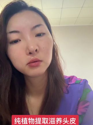 纯植物提取滋养头皮 防脱控油~