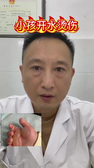 小孩烫伤急救!这步比涂药重要10倍,正确做法 ✅ 流动凉水冲15-20分钟