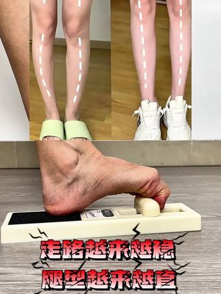 腿型好看的足弓都好看!这个冬天练起来,夏天就直了! #纠正腿型 #腿型改善 #足弓训练器 #扁平足 #小腿外翻
