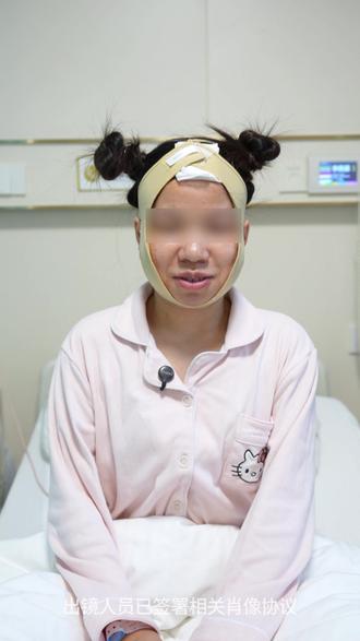下颌角术后第二天,问问求美者的真实感受 #下颌角磨骨 #下颌角长曲线 #磨骨改脸型 #磨骨第三天 #查房