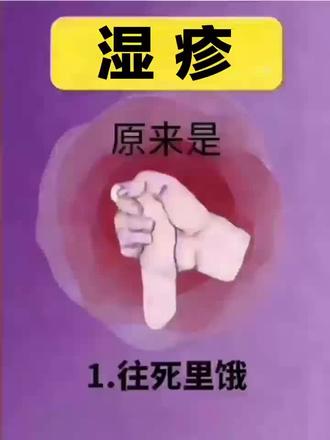 记住这些就够了#湿疹#湿疹护理#湿疹反复#艾涵诺